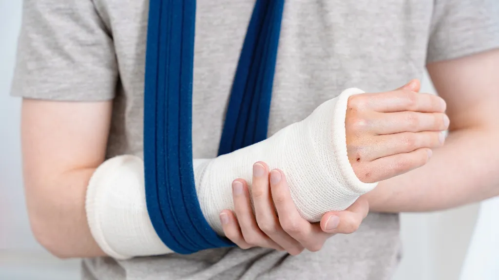 Person wearing a gray shirt with a white arm cast supported by a blue sling.