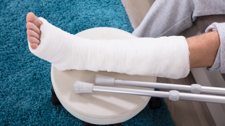 Man with a cast on his leg